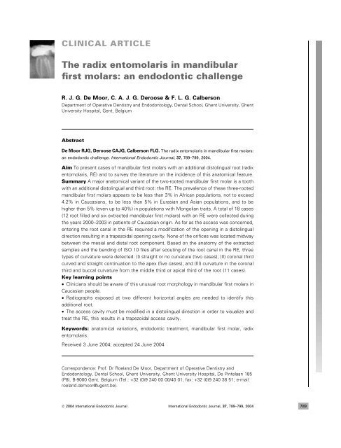 The Radix Entomolaris In Mandibular First Molars An Endodontic