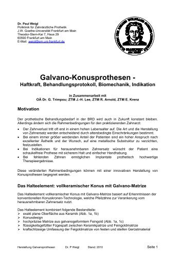 Galvano-Konusprothesen - Dental Balance