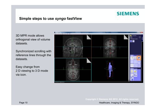 siemens syngo fastview