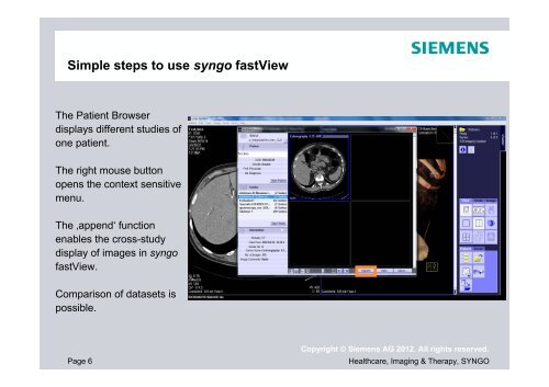 siemens syngo fastview