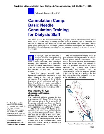 Cannulation Camp: Basic Needle Cannulation ... - Renal Network 11