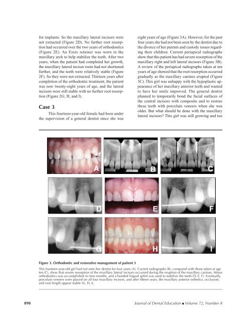 Orthodontic and Nonorthodontic Root Resorption - Journal of Dental ...