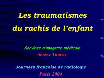 Les traumatismes du rachis de l'enfant