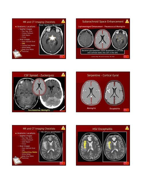 Critical Imaging Diagnoses: - Radiology