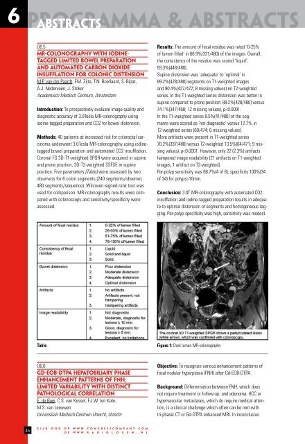 programma & abstracts - Nederlandse Vereniging voor Radiologie