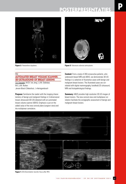 programma & abstracts - Nederlandse Vereniging voor Radiologie