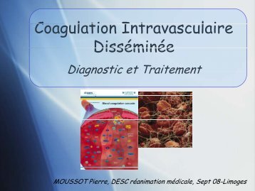 C l ti I t l i Coagulation Intravasculaire Disséminée