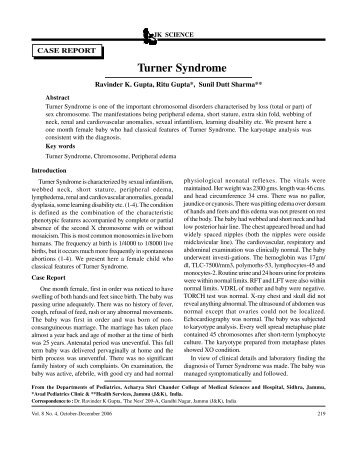 219 Turner Syndrome - JK Science