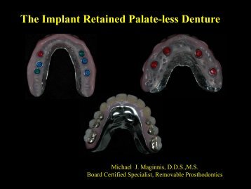 Palate-Less Maxillary Denture - ProSites