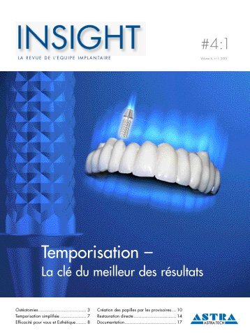 Temporisation simplifiÃ©e - Astra Tech