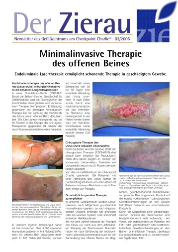 Minimalinvasive Therapie des offenen Beines - Saphenion