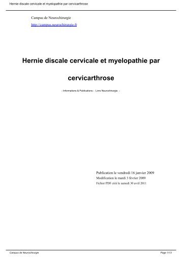 Hernie discale cervicale et myelopathie par cervicarthrose