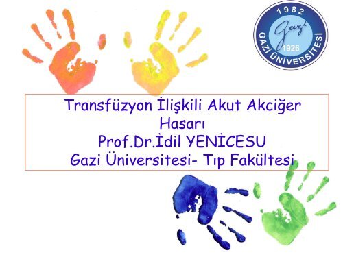 Transfüzyon İlişkili Akut Akciğer Hasarı