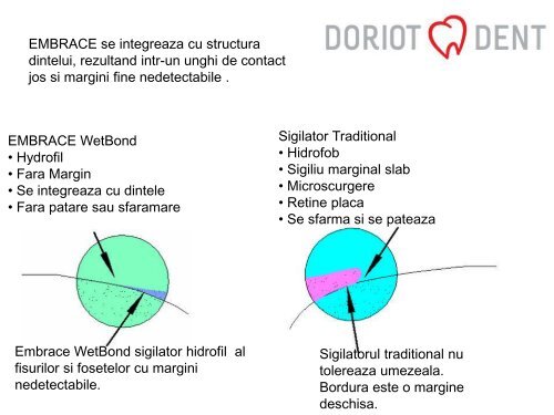 PULPDENT furnizeaza produse unice pentru ... - Doriot Dent (Ro)