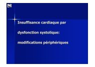 Physiopathologie de l'insuffisance cardiaque