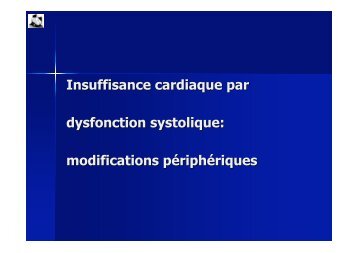 Physiopathologie de l'insuffisance cardiaque