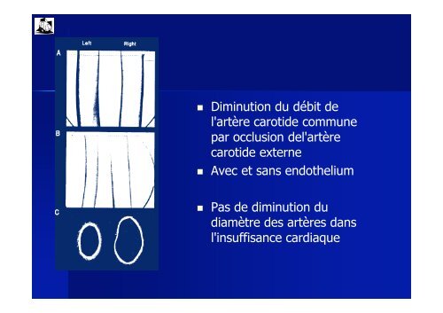 Physiopathologie de l'insuffisance cardiaque