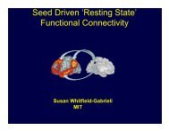 Seed Driven 'Resting State' Functional Connectivity - Neurometrika