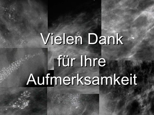 Neues Auftreten von Mikrokalk und Malignomrisiko