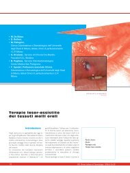 terapie laser assistite dei tessuti molli orali - doctor smile