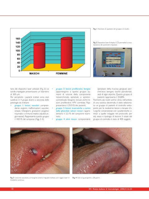 terapie laser assistite dei tessuti molli orali - doctor smile