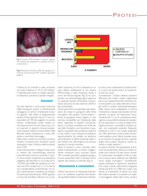 terapie laser assistite dei tessuti molli orali - doctor smile