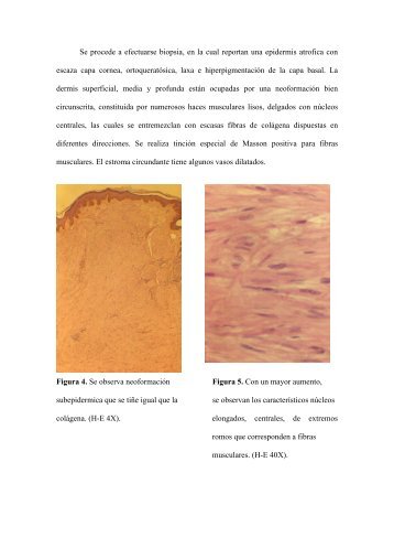 PILOLEIOMIOMAS MULTIPLES - PIEL-L Latinoamericana