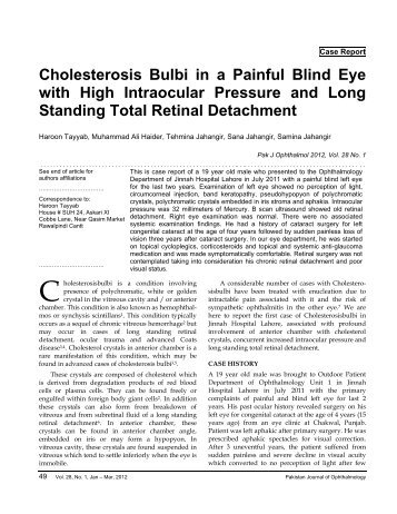 Cholesterosis Bulbi in a Painful Blind Eye with High Intraocular ...