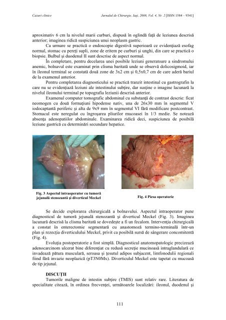 Full text PDF (3.9MB) - Jurnalul de Chirurgie