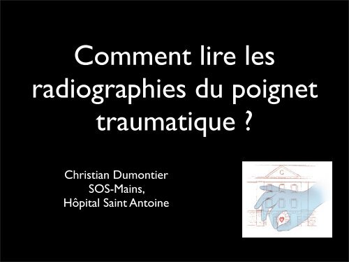 Comment lire une radio du poignet C. Dumontier - ClubOrtho.fr