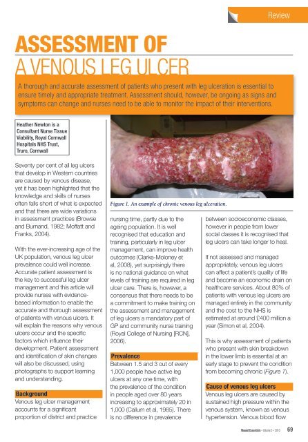 ASSESSMENT OF A VENOUS LEG ULCER - Wounds UK