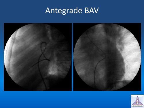 Valvular Heart Disease In Pediatric Age Group - RM Solutions