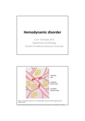 Hemodynamic disorder - Faculty of Medicine - มหาวิทยาลัยนเรศวร