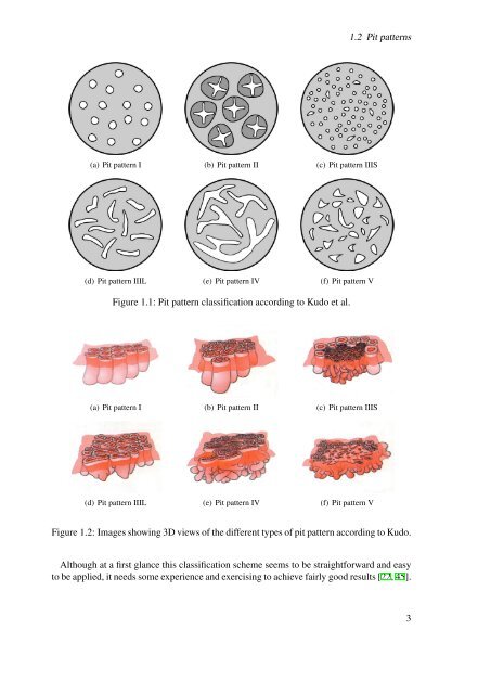 Pit Pattern Classification in Colonoscopy using Wavelets - WaveLab