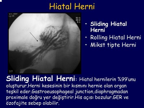 Diyafram ve gÃ¶ÄÃ¼s duvarÄ± lezyonlarÄ±