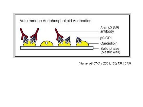 Antiphospholipid Syndrome.