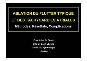 ABLATION DU FLUTTER TYPIQUE ET DES TACHYCARDIES ...