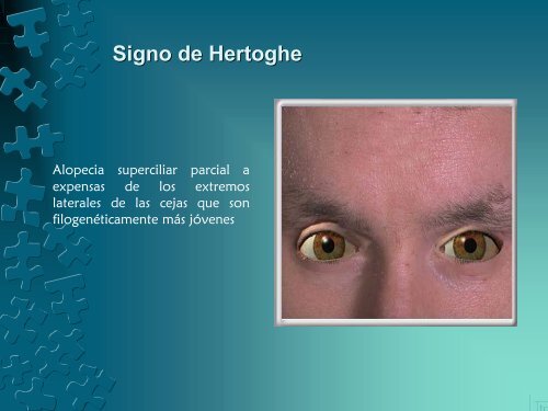 Signo