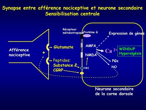 Douleur neuropathique