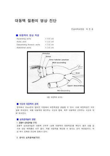 대동맥질환의 영상진단 - 전남대병원 박종춘 - 대한심장학회혈관연구회