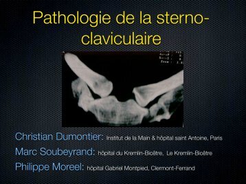 Pathologie sterno-claviculaire C. Dumontier et al - ClubOrtho.fr