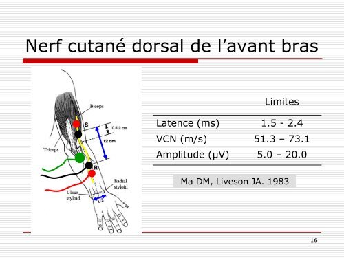 Nerfs sensitifs cutanÃ©s du membre supÃ©rieur - SociÃ©tÃ© d ...