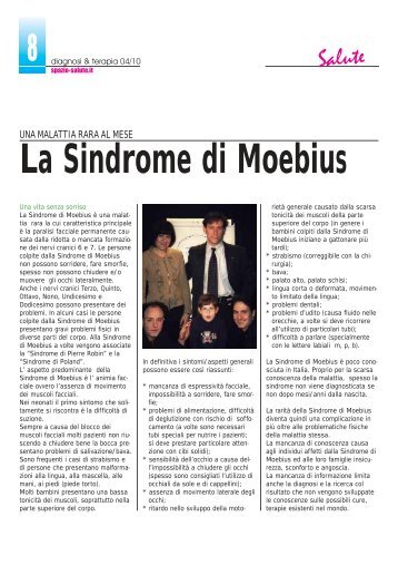 La Sindrome di Moebius - Diagnosi e Terapia