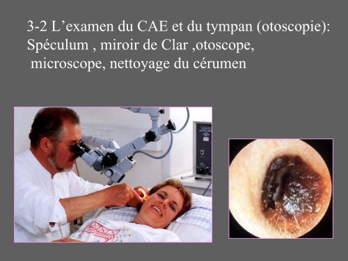 3- L'examen clinique otologique