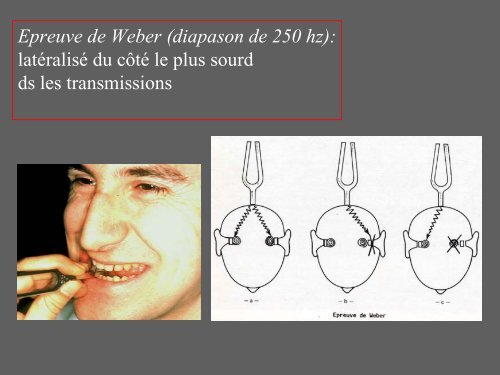 3- L'examen clinique otologique