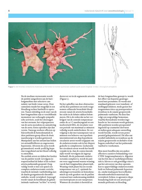 Thema: cardioanesthesiologie - Nederlandse Vereniging voor ...