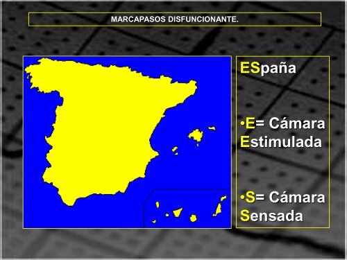 MARCAPASOS DISFUNCIONANTE. TIPOS DE ... - SEMM