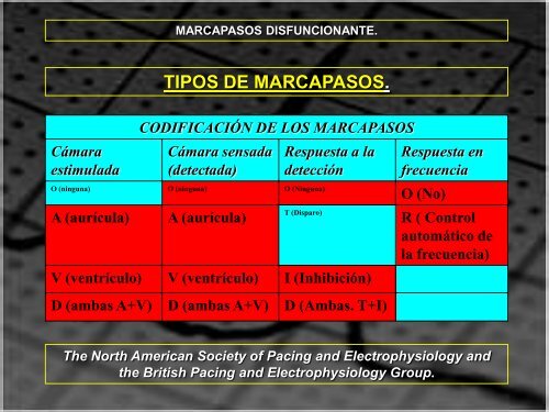 MARCAPASOS DISFUNCIONANTE. TIPOS DE ... - SEMM