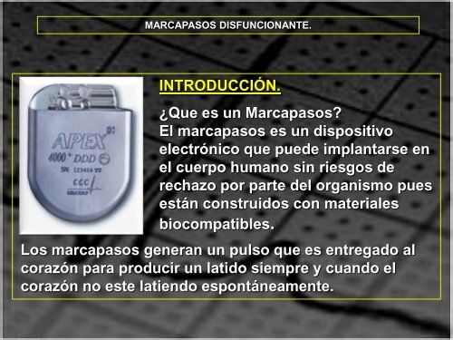 MARCAPASOS DISFUNCIONANTE. TIPOS DE ... - SEMM