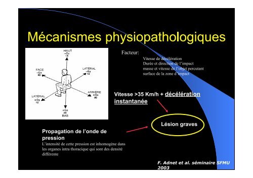 Rupture de l'isthme aortique - SMUR BMPM